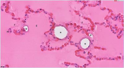 Suspected Acute Respiratory Distress Syndrome Associated With the Use of Intravenous Lipid Emulsion Therapy in a Dog: A Case Report